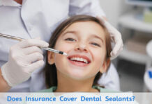 Does Insurance Cover Dental Sealants? Does Insurance Cover Dental Sealants?